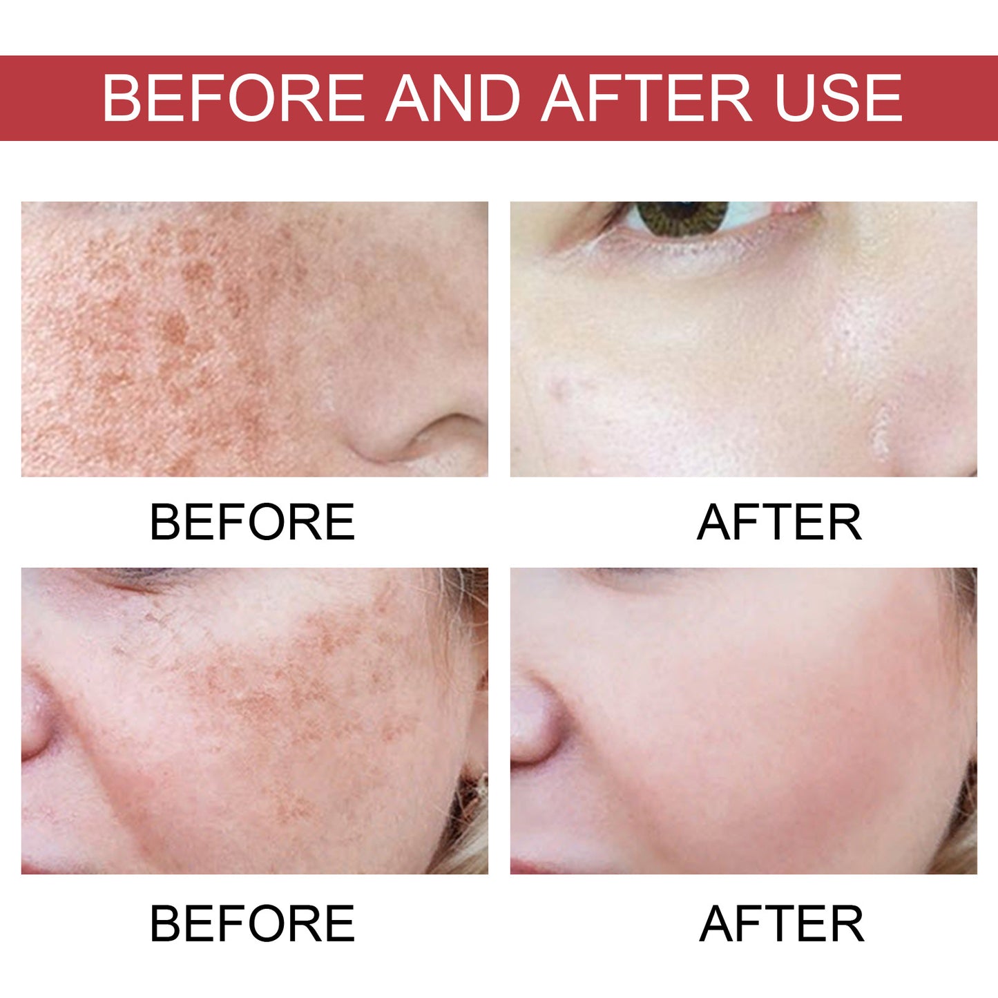 Black Spot & Age Spot Repair Essence — Brightening & Moisturising Serum
